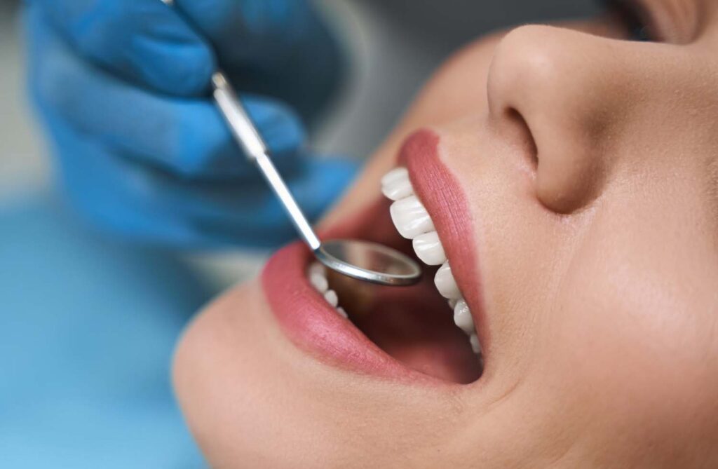 4 Benefits of Porcelain Dental Veneers