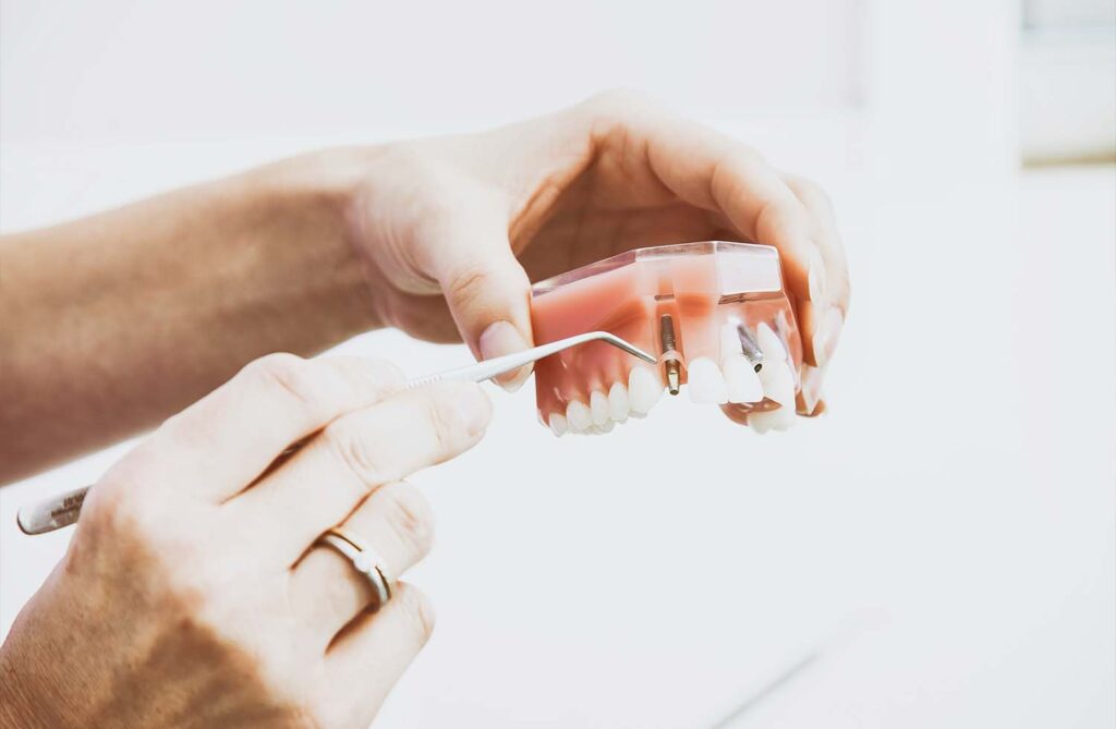Evaluating Whether a Dental Veneer is Good for You