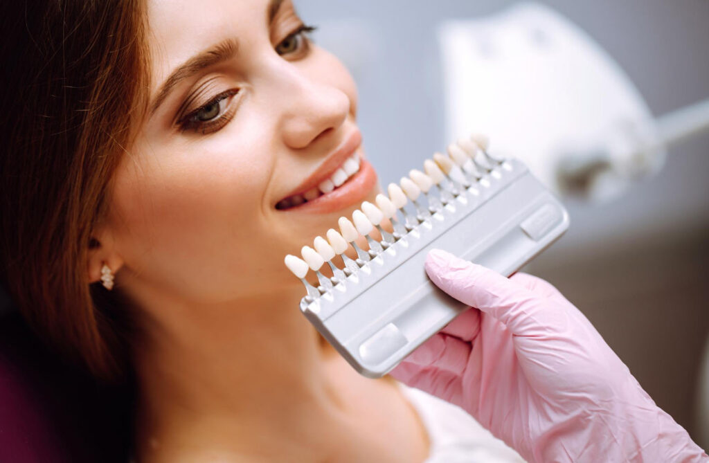 Understanding Composite Veneers
