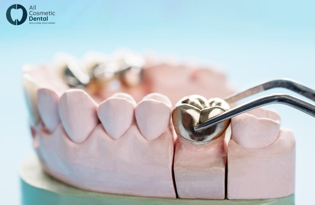 How-Does-Getting-a-Same-Day-Crown-Work