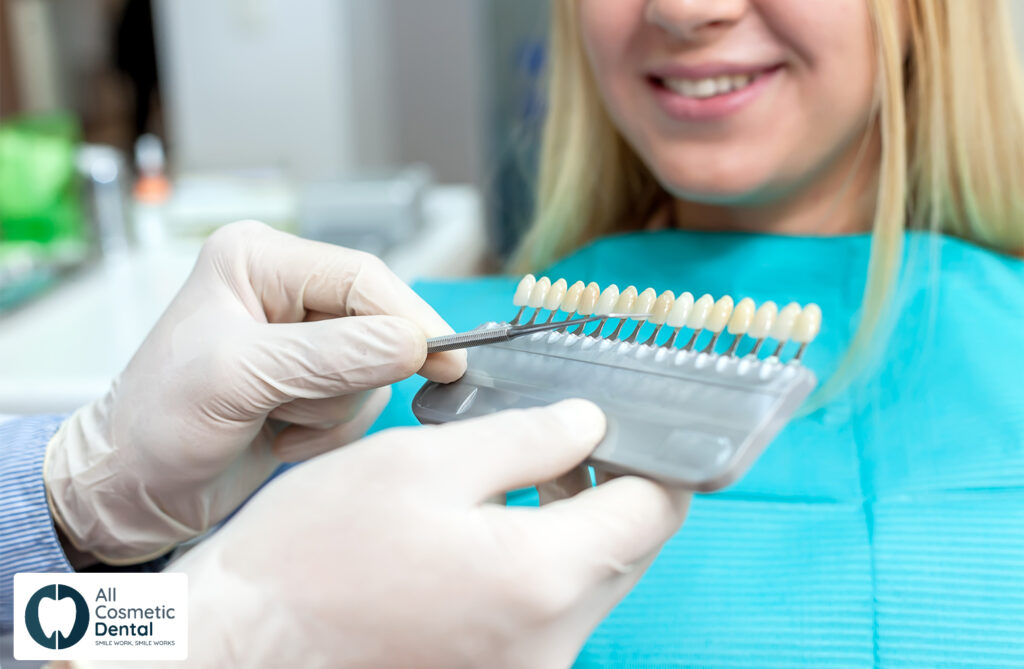 5-Things-to-Consider-Before-Getting-Cosmetic-Veneers